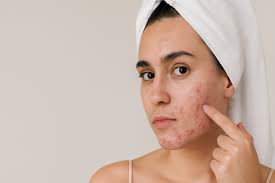 Acne Improvement Icon