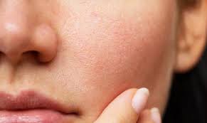 Minimized Pores Icon