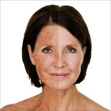 Reduced Sun Damage Icon