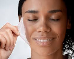 Jessner's Peel