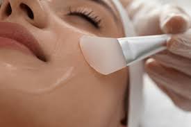 Facial Peels