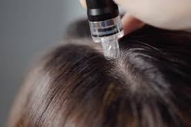 Scalp Treatment